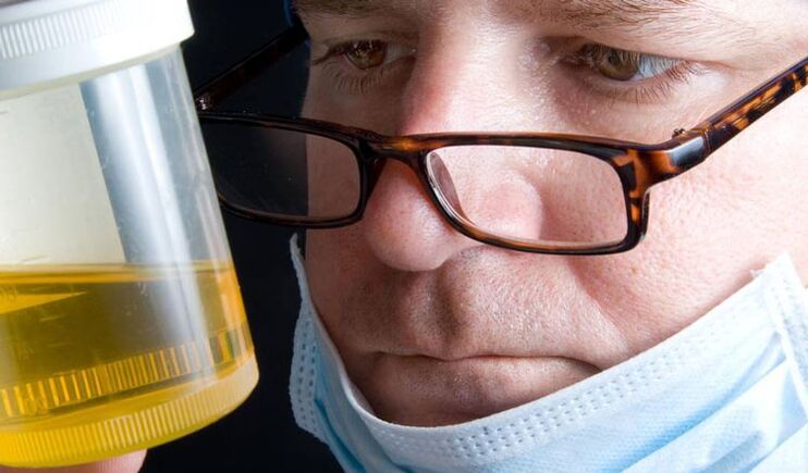 Prostatīta diagnoze