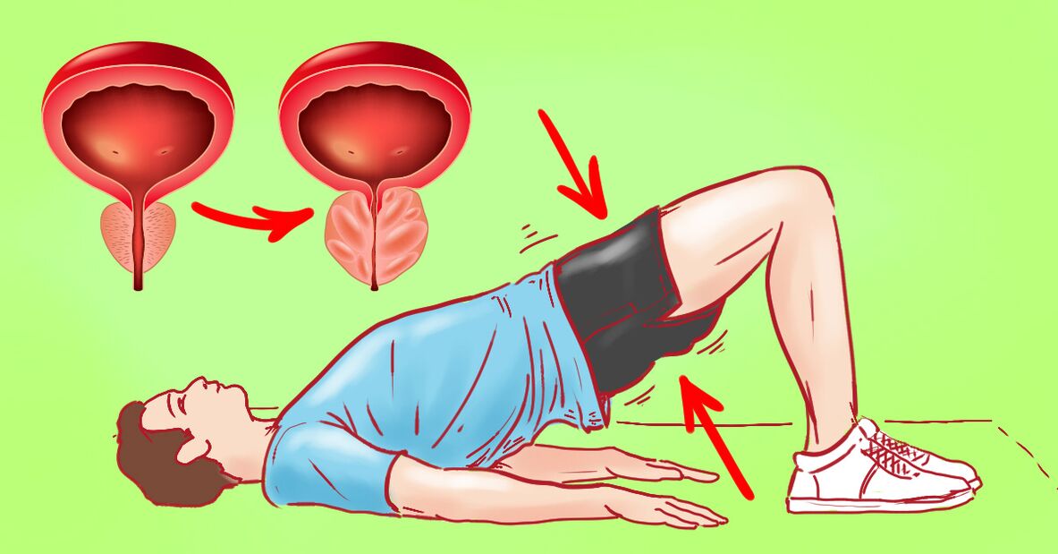 vingrošanas vingrinājumi prostatīta ārstēšanai